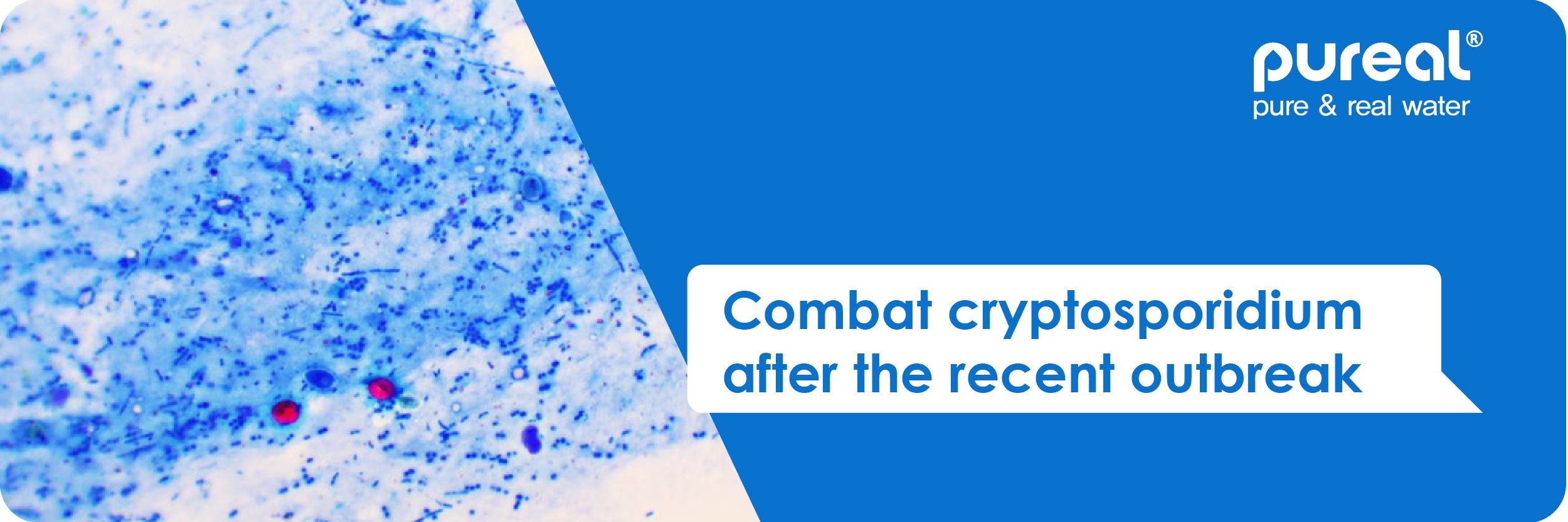 Combat cryptosporidium after the recent outbreak
